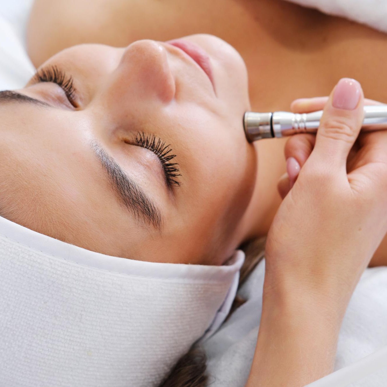 Exfoliation Dermabrasion — 80 min